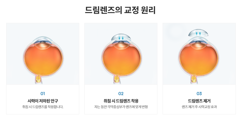 반포드림렌즈
